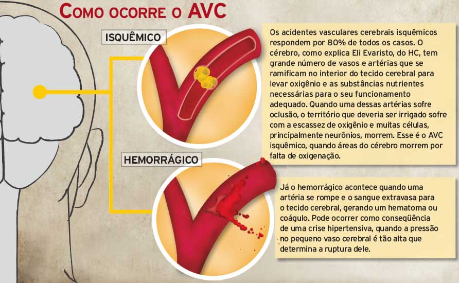 tipos de avc